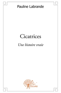 Cicatrices