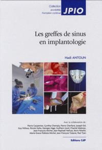 LES GREFFES DE SINUS EN IMPLANTOLOGIE