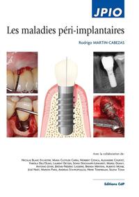 LES MALADIES PERI-IMPLANTAIRES