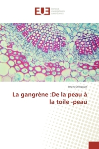 La gangrène :De la peau à la toile -peau