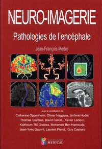 NEURO-IMAGERIE. PATHOLOGIES DE L ENCEPHALE