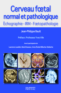 Cerveau foetal normal et pathologique -Echographie, IRM, Foetopathologie
