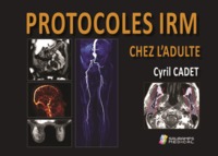 PROTOCOLES IRM CHEZ L ADULTE