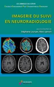 IMAGERIE DU SUIVI EN NEURORADIOLOGIE