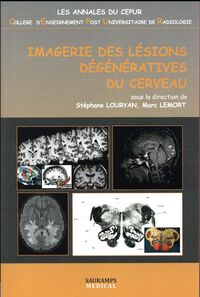 IMAGERIE DES LESIONS DEGENERATIVES DU CERVEAU