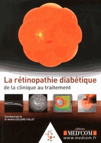 LA RETINOPATHIE DIABETIQUE :DE LA CLINIQUE AUTRAITEMENT