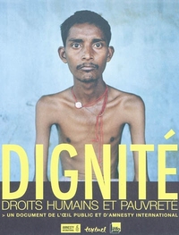 DIGNITE