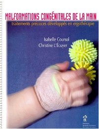 MALFORMATIONS CONGENITALES DES MAINS