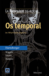 RADIOLOGIE DE POCHE - OS TEMPORAL. LES 100 PRINCIPAUX DIAGNOSTICS