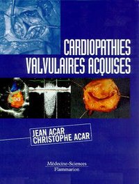 Cardiopathies valvulaires acquises