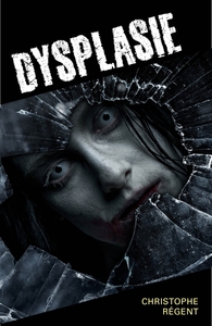 DYSPLASIE