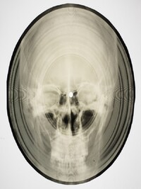 BONE MUSIC: SOVIET X-RAY AUDIO /ANGLAIS