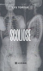 SCOLIOSE