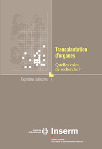 TRANSPLANTATION D'ORGANES. QUELLES VOIES DE RECHERCHE ?