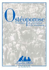 OSTEOPOROSE, STRATEGIES DE PREVENTION ET DE TRAITEMENT