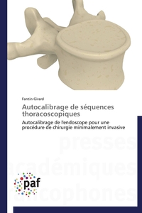 Autocalibrage de séquences thoracoscopiques