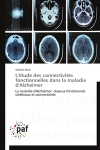 L'ETUDE DES CONNECTIVITES FONCTIONNELLES DANS LA MALADIE D'ALZHEIMER