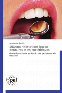 Sida:manifestations bucco-dentaires et enjeux éthiques