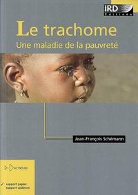 LE TRACHOME. UNE MALADIE DE LA PAUVRETE - UNE MALADIE DE LA PAUVRETE.