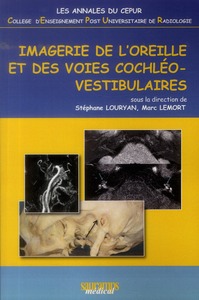 IMAGERIE DE L'OREILLE ET DES VOIES COCHLEO-VESTIBULAIRES - ANNALES DU CEPUR