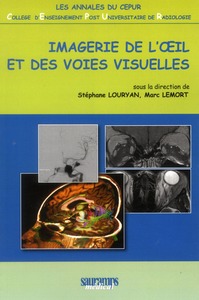 IMAGERIE DE L'OEIL ET DES VOIES VISUELLES