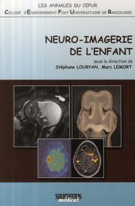 NEURO IMAGERIE DE L ENFANT