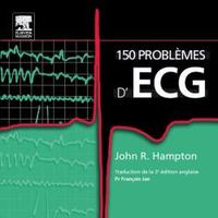 150 PROBLEMES D'ECG