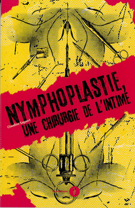 La nymphoplastie - Une chirurgie de l’intime