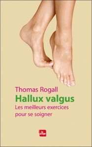 Hallux valgus