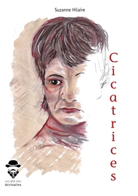 Cicatrices