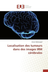 Localisation des tumeurs dans des images irm cérébrales