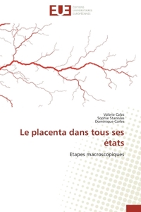 Le placenta dans tous ses états