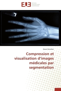 Compression et visualisation d'images médicales par segmentation