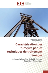 Caractérisation des tumeurs par les techniques de traitement d'images