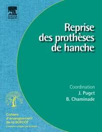 REPRISE DES PROTHESES DE HANCHE