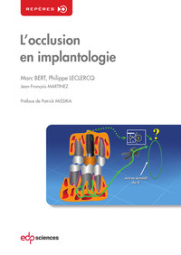 OCCLUSION EN IMPLANTOLOGIE