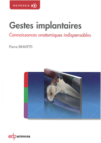 GESTES IMPLANTAIRES,CONNAISSANCES ANATOMIQUES INDISPENSABLES