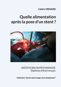 Quelle alimentation après la pose d'un stent ?