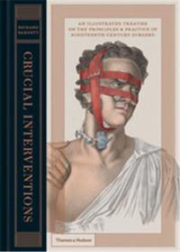 CRUCIAL INTERVENTIONS ILLUSTRATED TREATISE ON 19TH CENTURY SURGERY /ANGLAIS