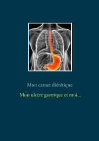 Mon carnet diététique : mon ulcère gastrique et moi...