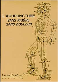 Acupuncture sans piqûre sans douleur