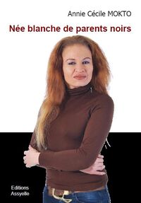 Née blanche de parents noirs