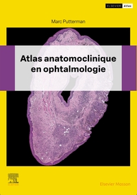 ATLAS ANATOMOCLINIQUE EN OPHTALMOLOGIE