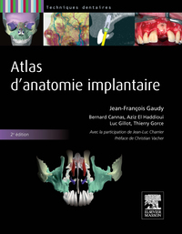 Atlas d'anatomie implantaire