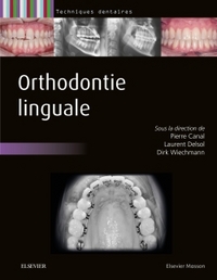 ORTHODONTIE LINGUALE