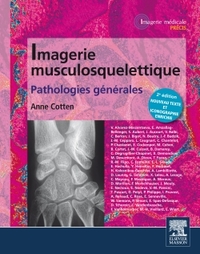IMAGERIE MUSCULOSQUELETTIQUE : PATHOLOGIES GENERALES