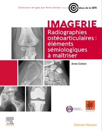 RADIOGRAPHIES OSTEOARTICULAIRES : ELEMENTS SEMIOLOGIQUES A MAITRISER