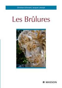 Les brûlures