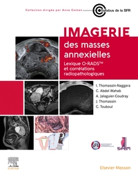 IMAGERIE DES MASSES ANNEXIELLES - LEXIQUE O-RADS ET CORRELATIONS RADIOPATHOLOGIQUES