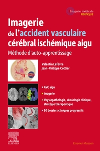 Imagerie de l'accident vasculaire cérébral ischémique aigu